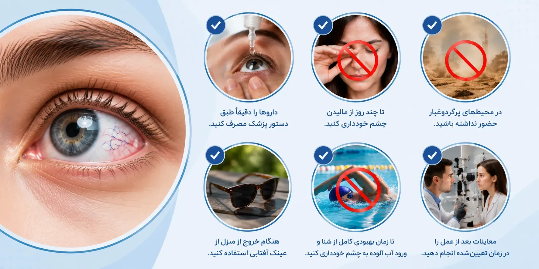 جراحی ناخنک چشم